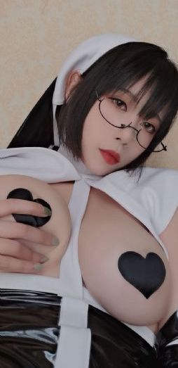 月嫂烫伤出生27天婴儿